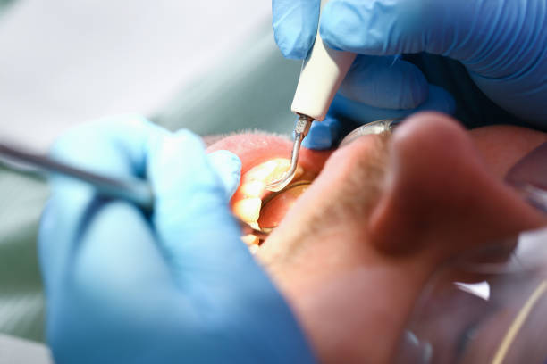Best Tooth Infection Emergency Dentist  in Rosanky, TX