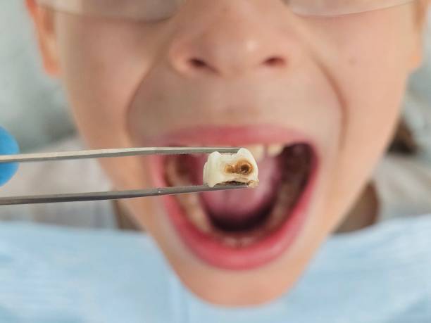 Best Broken Tooth Emergency  in Rosanky, TX