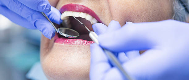 Best Urgent Tooth Repair  in Rosanky, TX